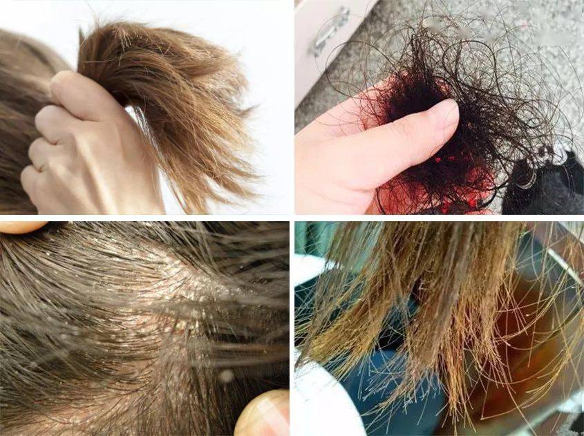 技干发帽三分钟速干轻松告别湿哒哒！pg电子中国网站女生值得用的黑科(图3)